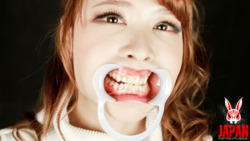 아사히나 나나코의 치아를 주관 관찰! 충치 발견!