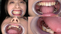 “[戀牙癖] 觀察人氣女星由希奈緒極其罕見的牙齒，滿嘴都是銀牙！！！”