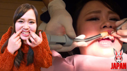 Dental Treatment ; Amateur Girl MEGUMI (25)  (3rd Time)  FINAL!!