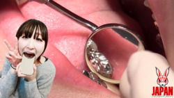 Dental Treatment ; Amateur Girl AOI (4th Time: Extreme Close Up of MOUTH)