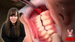 素人Megumi（25）的牙科治療影片（第二次：口腔特寫）*這是同名作品，僅包含口腔內部特寫！