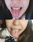 Thick tongue coating!! Dirty tongue slutty girl!! [All 11 items included!!] Slender and neat college student Yuki&#39;s &quot;sour breath, tongue, saliva, vagina, armpits, anus, etc.&quot; Special fetish value set for smell torture ①