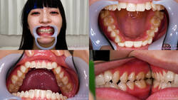 [Tooth fetish] We observed Meru Adachi&#39;s teeth!