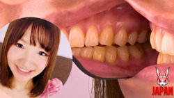 사사키 히나코 치아 관찰 천연 치아와 마음과 충치가!